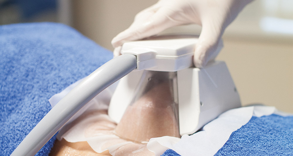 How Fat Freezing and HIFU Work Together? 2 Multiple Areas in One Session HIFU and Fat Freezing Walthams Cross