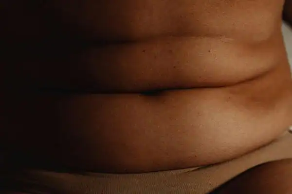 The Hidden Connection: How Stress Shapes Your Fitness and Body Composition 3 image of what stress can do on the stomach area and how Lipo 360 Walthams Cross can help to change your body shape.